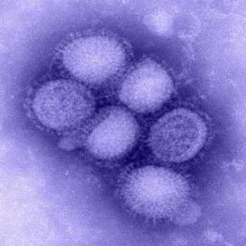 Immagine tramite microscopio Elettronico del Virus A/H1N1